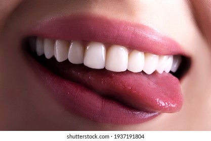 Perfect Close Up White Beautiful Veneers Teeth Bleaching Crowns Whitening Young Lady Smiling, Sensual Sexy Seductive Plump Lips Woman Smile. Dental Zircon Implants Restoration Surgery. Fashion Concept