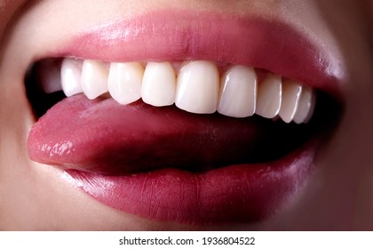 Perfect Close Up White Beautiful Young Lady Smiling Plump Lips Smile Veneers Teeth Bleaching Crowns Whitening . Dental Zircon Implants Restoration Surgery. Fashion Concept