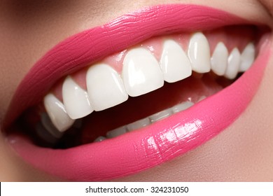 Perfect Smile Before And After Bleaching. Dental Care And Whitening Teeth. Smile With White Healthy Teeth. Healthy Woman Teeth And Smile And Sexy Full Pink Lips