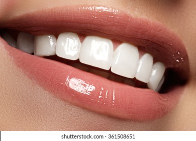 Perfect Smile Before And After Bleaching. Dental Care And Whitening Teeth