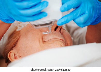 Performing laser resurfacing using an ablative laser on the skin of a patient face in an aesthetic medicine center