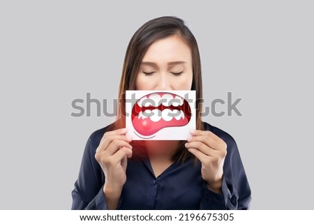 Periodontal disease, Gingivitis or inflammation of the gums Stockfoto © 