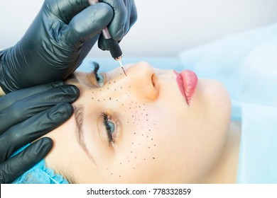 Permanent Microblasting Tattooing Freckles To A Woman In A Beauty Salon