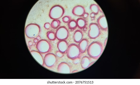 Permanent Preparation Of Beet Root, Xylem Tissue