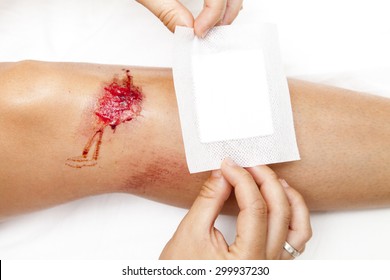 Person with fresh bleeding wounds on the knees The damage is treated with an adhesive bandage, to prevent the blood from flowing. Against white background, closeup