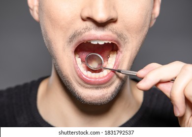 Person mit Mundspiegel überprüft die Rückseite der vorderen Zähne, ob Karies oder andere Bakterien vorhanden sind 