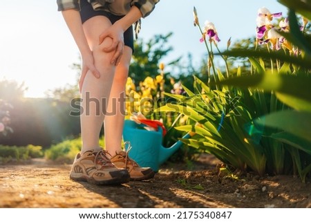Person scratches her legs, which is itchy from a mosquito bite. Close up. Below view. Summer garden on the background. Allergies and insect bites concept.