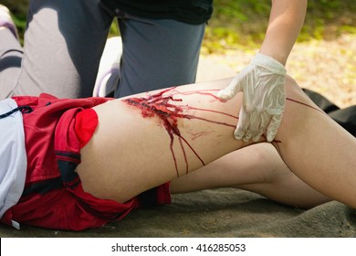 Person with serious leg injury, receiving first aid treatment. Medical exercise, artificial blood