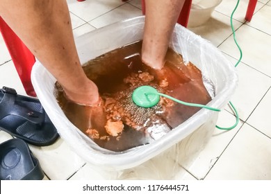 Person Undergoing Foot Detox Treatment With Ion Cleansing Detox Machine