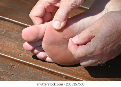 Person using a needle to get a splinter  out of their foot