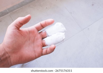 A person's open hand is shown with two fingers wrapped in white bandages, indicating an injury or medical treatment