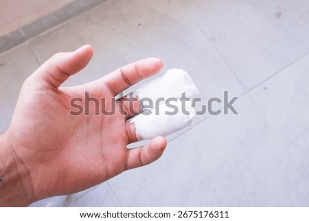 A person's open hand is shown with two fingers wrapped in white bandages, indicating an injury or medical treatment