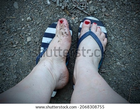 Perspective shot looking down at feet in blue striped, thong sandals.  Pale skin and toes have pebbles stuck to them. The toenails have been painted red on these female, plus sized feet.