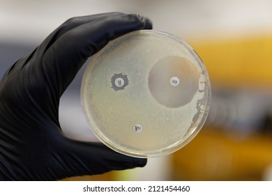 A Pertri plate showing the resistance of bacteria to antibiotics. If the bacteria is resistant the zone of inhibition will not form. - Shutterstock ID 2121454460