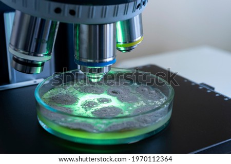 A petri dish with bacteria under a microscope, highlighted in green, the close-up. Do the science of the future in the laboratory.