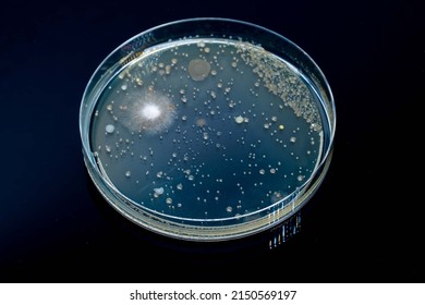 Petri dish with biological samples in a   laboratory of a medical clinic