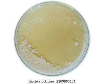 Petri dish hosting thriving Pichia pastoris yeast culture. Abundant, creamy-white colonies cover the agar surface, showcasing the yeast's prolific growth and optimal conditions for protein expression.