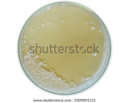 Petri dish hosting thriving Pichia pastoris yeast culture. Abundant, creamy-white colonies cover the agar surface, showcasing the yeast's prolific growth and optimal conditions for protein expression.