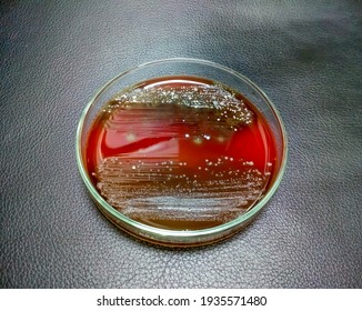 Petri Dish. Microbiological Laboratory. Enterobacter Colony On Blood Agar Media. Bacterial Research