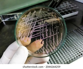 Petri Dish. Microbiological Laboratory. Urine Culture. Bacterial Research