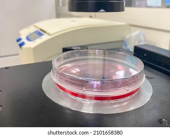 Petri Dish With Pancreatic Cancer Cells Growing In Dedicated Cell Culture Media. The Dish Is Placed Under A Microscope For Inspection Of Cell Fitness. 