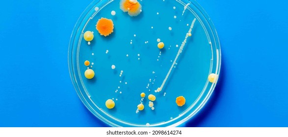 Petri Dish With Pathological Microbe Colonies