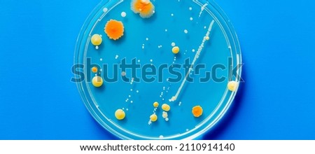 Petri dish with pathological microbe colonies