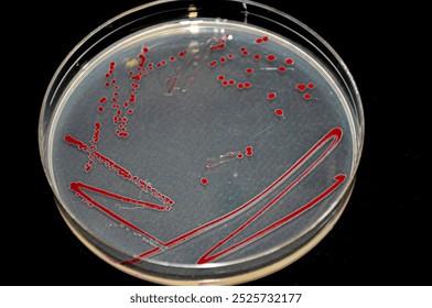 Petri dish with red colony of bacteria - Powered by Shutterstock