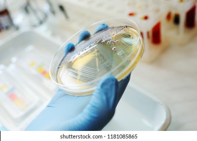 Petri dishes in the bacteriological laboratory