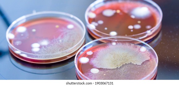 petri dishes with colonies of microorganisms in a biological laboratory