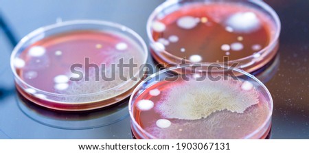 petri dishes with colonies of microorganisms in a biological laboratory