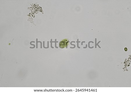 Phacus is a genus of unicellular euglenoids, of the phylum Euglenozoa (also known as Euglenophyta), characterized by its flat, leaf-shaped structure, and rigid cytoskeleton known as a pellicle.