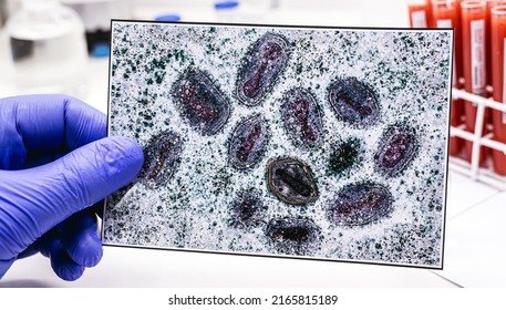 Pharmacist's Hand With Latex Glove Holding Monkeypox Vaccine, With Smallpox Virus Photo In The Background