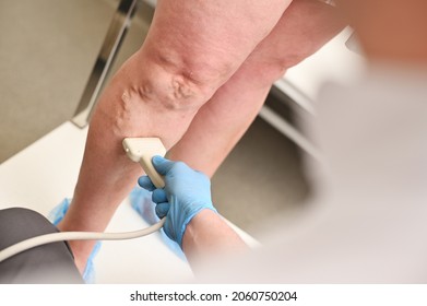 a phlebologist does an ultrasound of the veins of a patient with varicose veins.phlebology - study of venous pathologies of the lower extremities