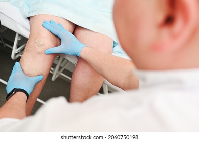 a phlebologist examines a patient with varicose veins on his leg. phlebology - study of venous pathologies of the lower extremities