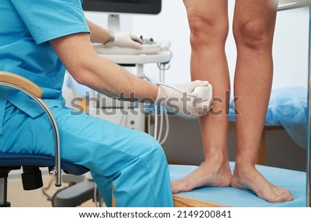 Phlebologist examining the condition of leg veins with an ultrasound machine