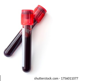 Phlebotomy, biochemical analysis, laboratory exam and blood testing concept theme with two test tubes isolated on white background with copy space