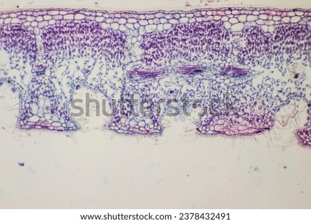 Phomicrograph of  Nerium indicum leaf crossection