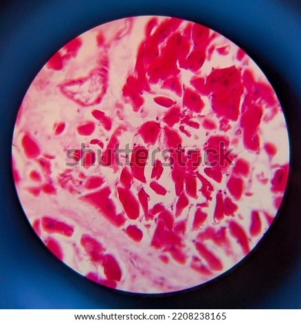 photo of adipose tissue under the microscope