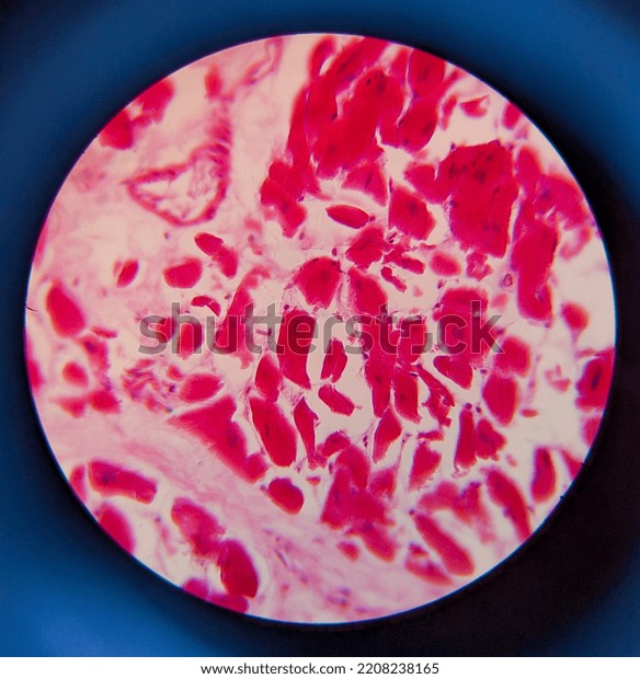 Photo Adipose Tissue Under Microscope Stock Photo 2208238165 | Shutterstock