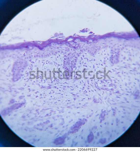 photo of\
cartilage bone tissue under the\
microscope