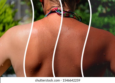 photo collage. back of a girl in a bikini with a demonstration of different shades of tan - Shutterstock ID 1546642259