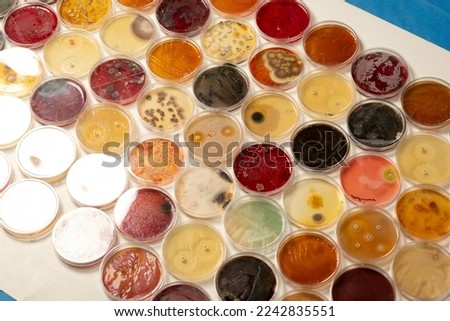 photo of collection of plastic plates containing culture media with growth of microorganisms