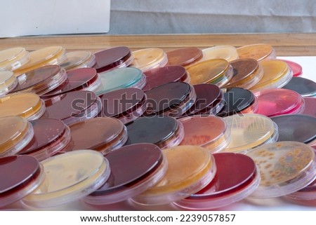 photo of collection of upside down plastic plates contain different culture media
