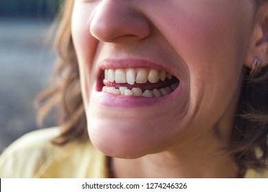 Photo Of Crooked Woman Teeth