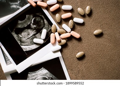 Photo of the fetus on an ultrasound scan and few pills on brown background. Ultrasound results in the 2 trimester of pregnancy.  Infertility treatment. Artificial insemination. Having a baby with IVF.