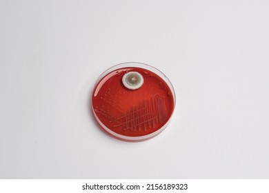 photo of fungal growth in blood agar plate
