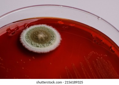 photo of fungal growth in blood agar plate