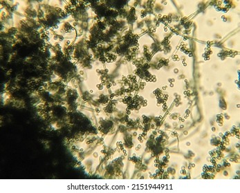 photo of fungi hyphae with spores under the microscope