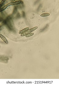 photo of fungi hyphae with spores under the microscope